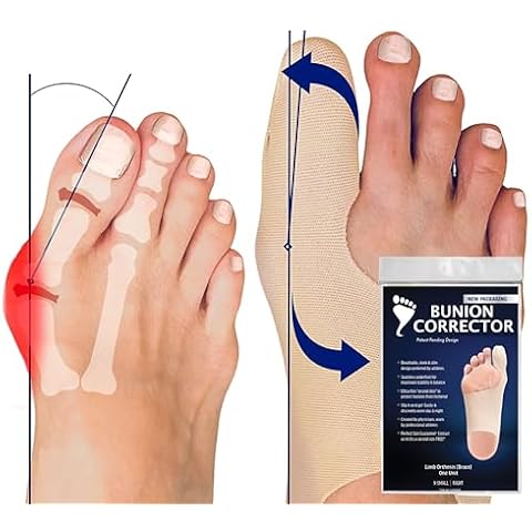 Bunion Bootie thumbnail