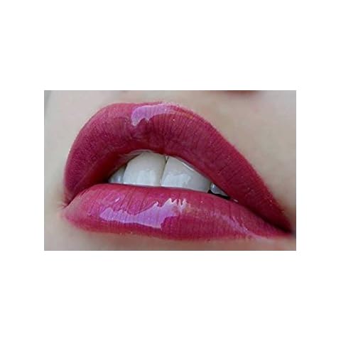 Chinoxia thumbnail