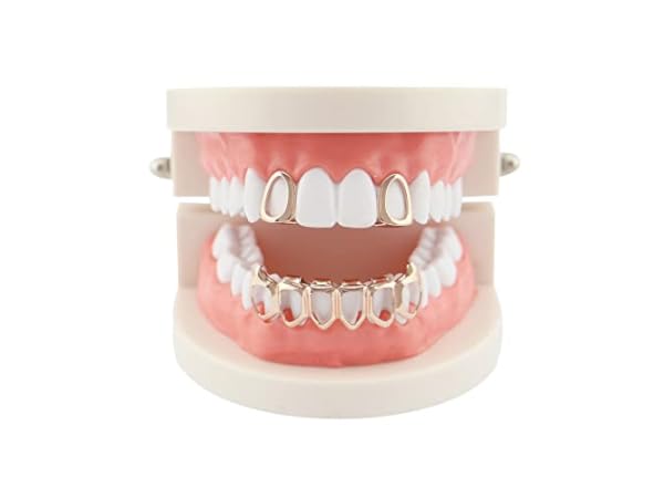 Dental Grills for Women Thumbnail