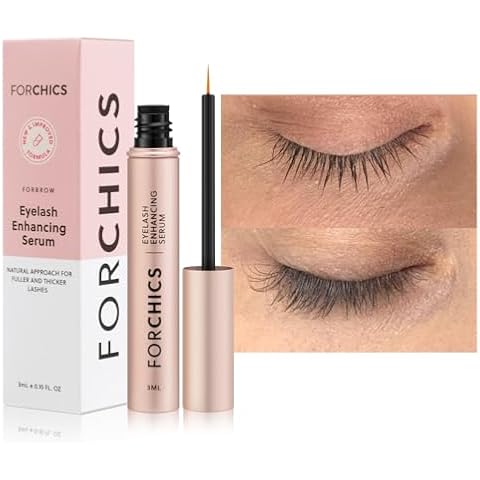 ForChics thumbnail