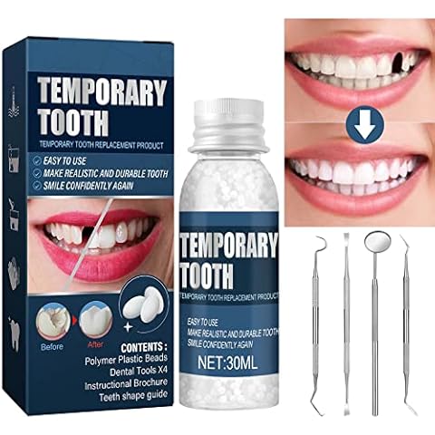 OrVance® Temporary Tooth Repair
