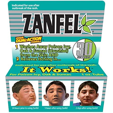 Zanfel thumbnail